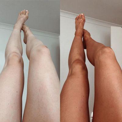 before & after legs