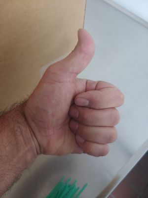 Thumbs up