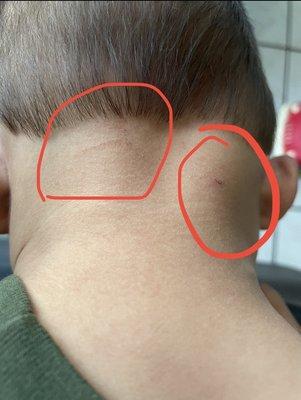 The lady cut my son on both sides and the back