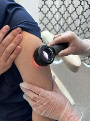 Our practice uses a dermatoscope for skin checks to accurately diagnosis and detect early signs of skin cancer.