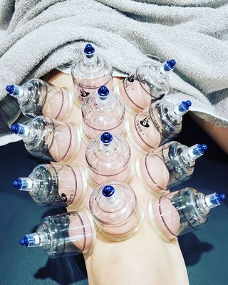 Medical cupping with functional movement.