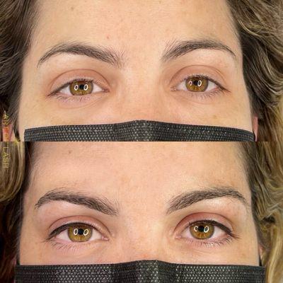 Cosmetic tattooing- permanent eyeliner