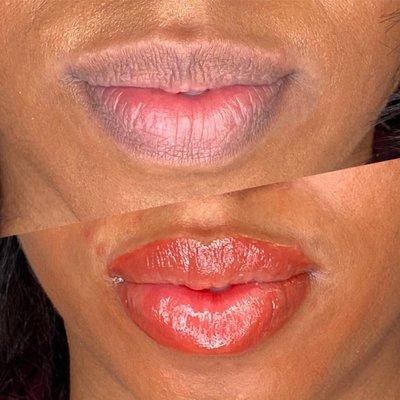 Before & After Lip Blush procedure