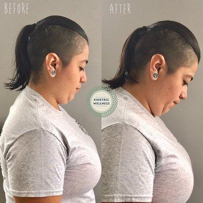 Before and after one session. Client came in with severe neck pain and limited ROM