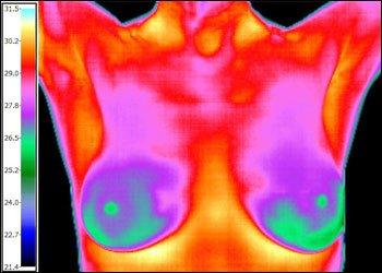 Sample Thermology Screening