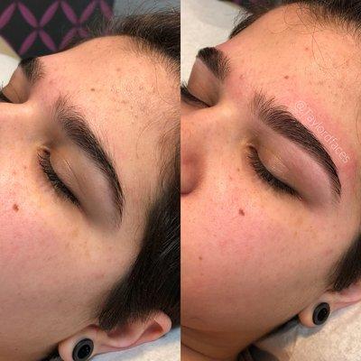 Brow shaping