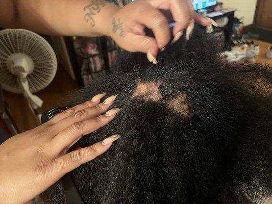 My daughter had very healthy 4C hair and no scalp issues. After going to Nikki, this is the damage.