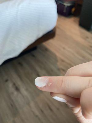 Bubble that began in this nail less than 24 hours after gel manicure and has grown since