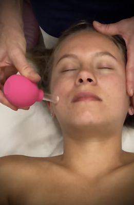 Facial Cupping for Lymphatic Drainage.  Included in the Therapeutic Facial.