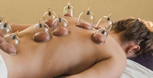 Cupping therapy