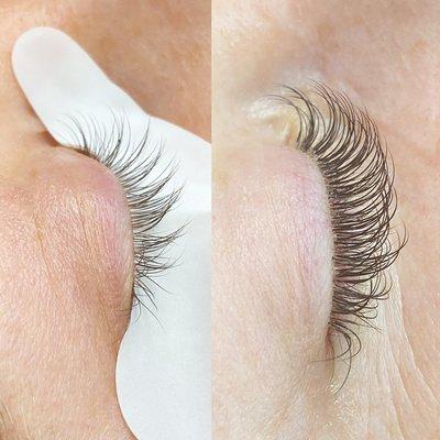 Before and after Classic Lash Extensions