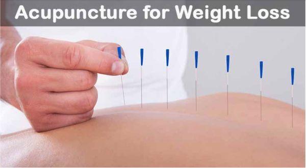 Acupuncture combined with a reduced calorie diet and herbs can deliver great results