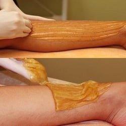 Legs Sugaring