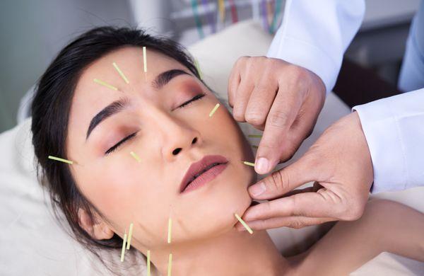 We offer Facial Rejuvenation/Cosmetic Acupuncture