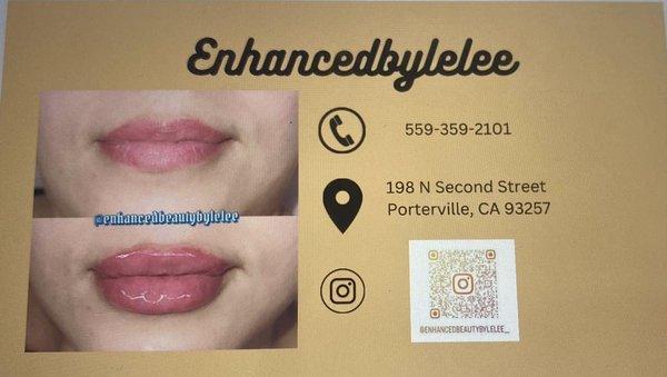 Facial & Lip Fillers .5cc 85$ 1ml 145$ 2ml 250$