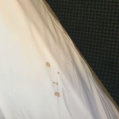 Sheets also had blood stains!!!