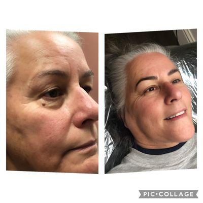 Before & after microblading