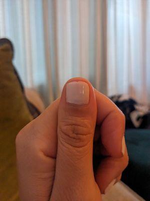 Very short left thumb nail ouch