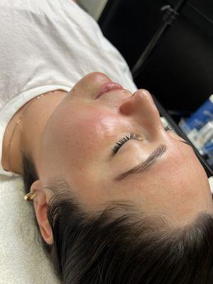 Dermaplane Facial