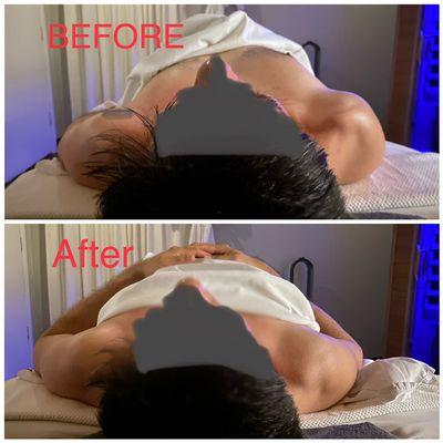 Right Shoulder & Neck pain