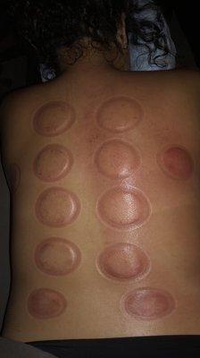 After my cbd oil massage with cupping, if you haven't tried it yet I strongly recommend that you do. I always feel brand spanking new!