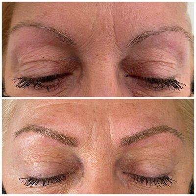 Microblading before and after