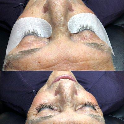 Before and after of classic eyelash extensions