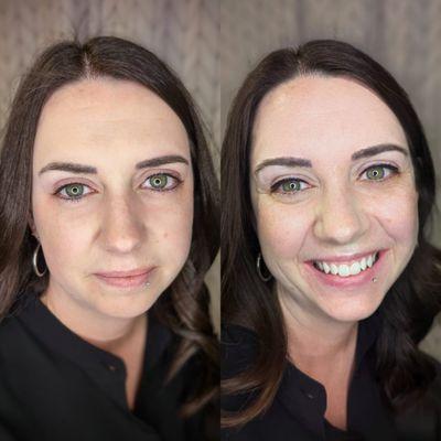 Permanent Eyeliner before and after