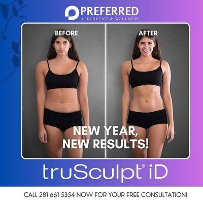 Body Sculpting Available!