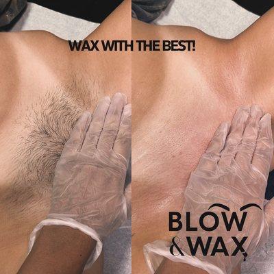 Before and after Brazilian wax