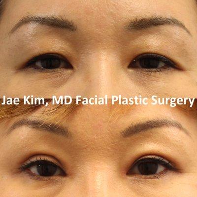 Jae Kim, MD Facial Plastic Surgery