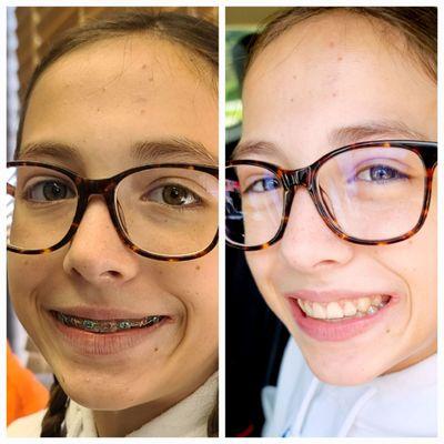 Before and after....twice the smile!