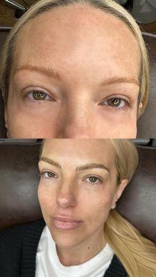 Before and after photos of micro bladed eyebrows by Amber.