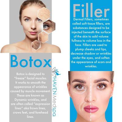 Botox vs filler