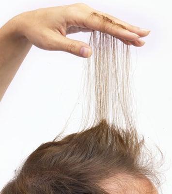 micropint Solutions instant hair !!  add 2-4 hairs to a single strand of hair.