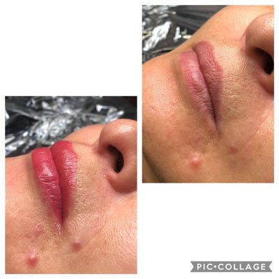 Permanent makeup lips