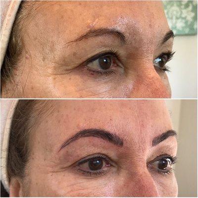 Before & After - Microblading