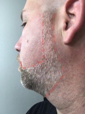 Jaw line shave 1 of 2 at Royal Fadez