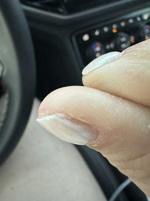 Nail not painted on side