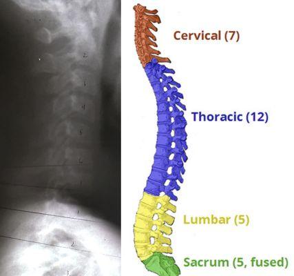 No wonder my neck felt stiff, it is completely straight, no natural curve.