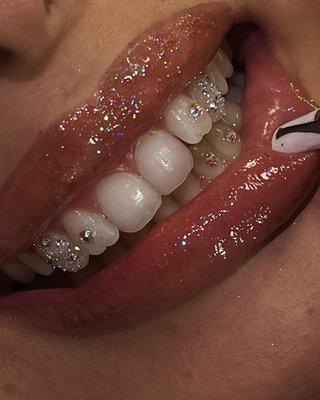 Toothgems