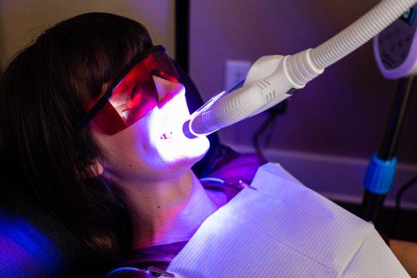 Organic Laser Teeth Whitening.