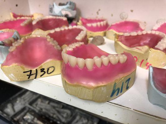 Custom made dentures