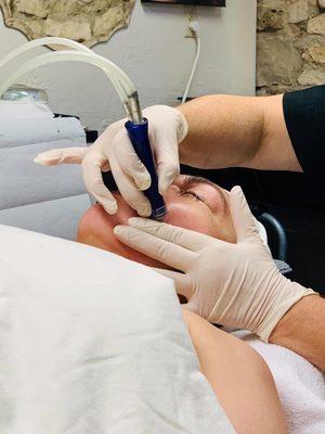 Spa De Rosa MICRODERMABRASION