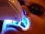 Professional Whitening Equipment