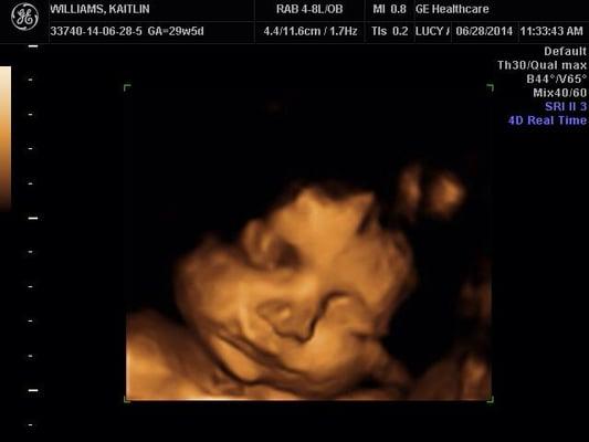 perfect picture of our little man thanks to Lucy! 29weeks