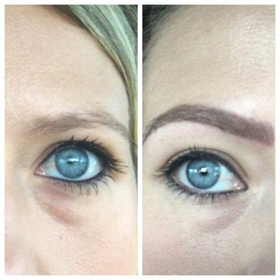 Reva is a miracle worker! This is before and a few minutes after the procedure: without ANY filters! I'm in awe!