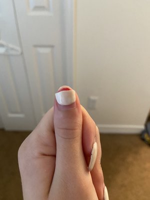 Broken, bleeding nail.