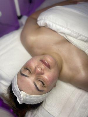 Glass Facial featuring the O2Derm machine