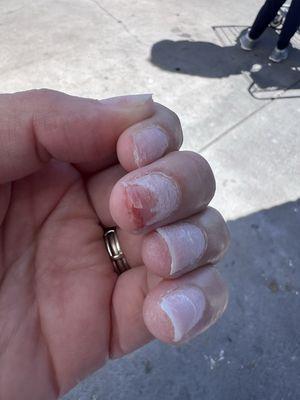 Acrylic Nail removal